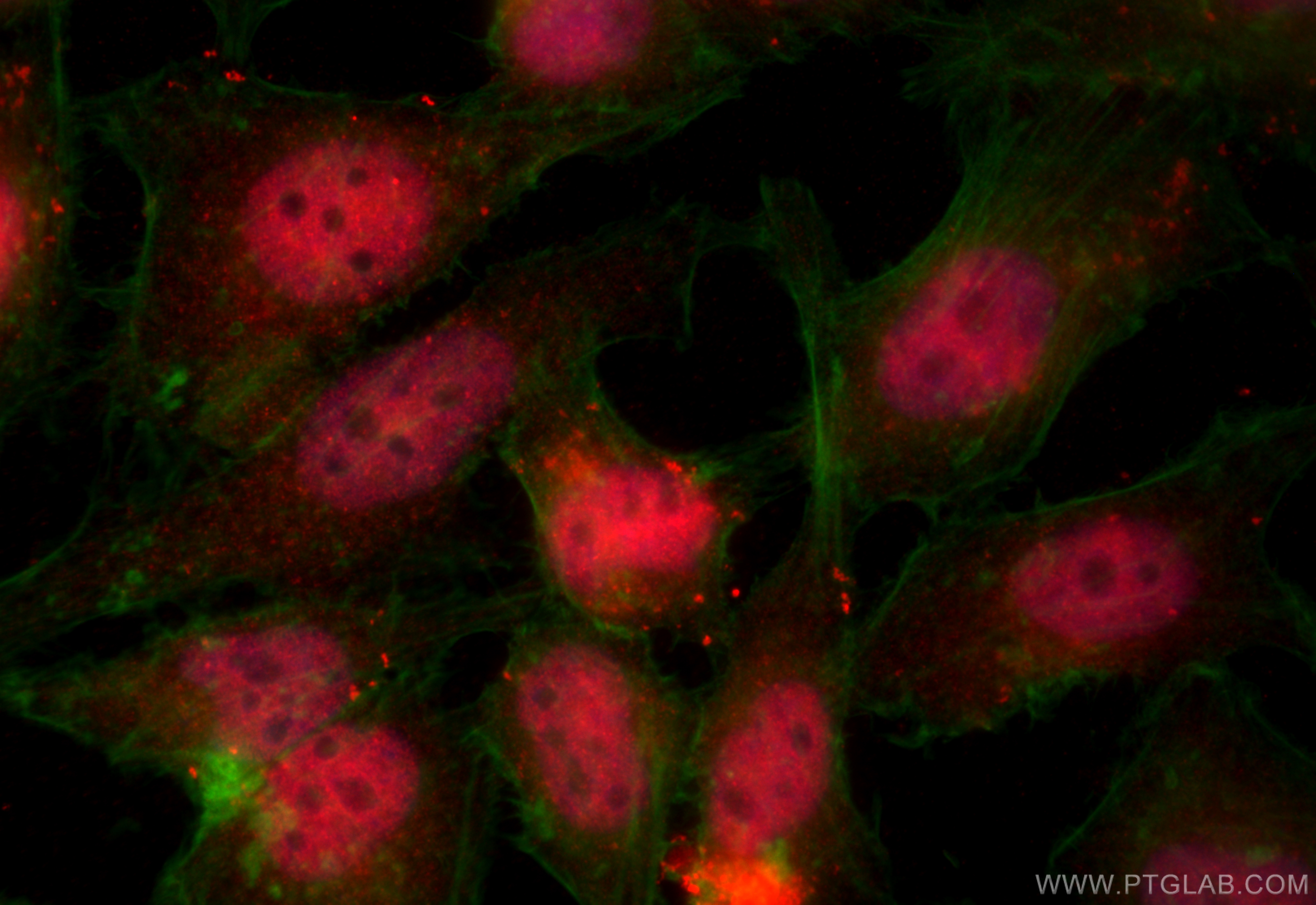 IF Staining of HeLa using 11015-2-AP