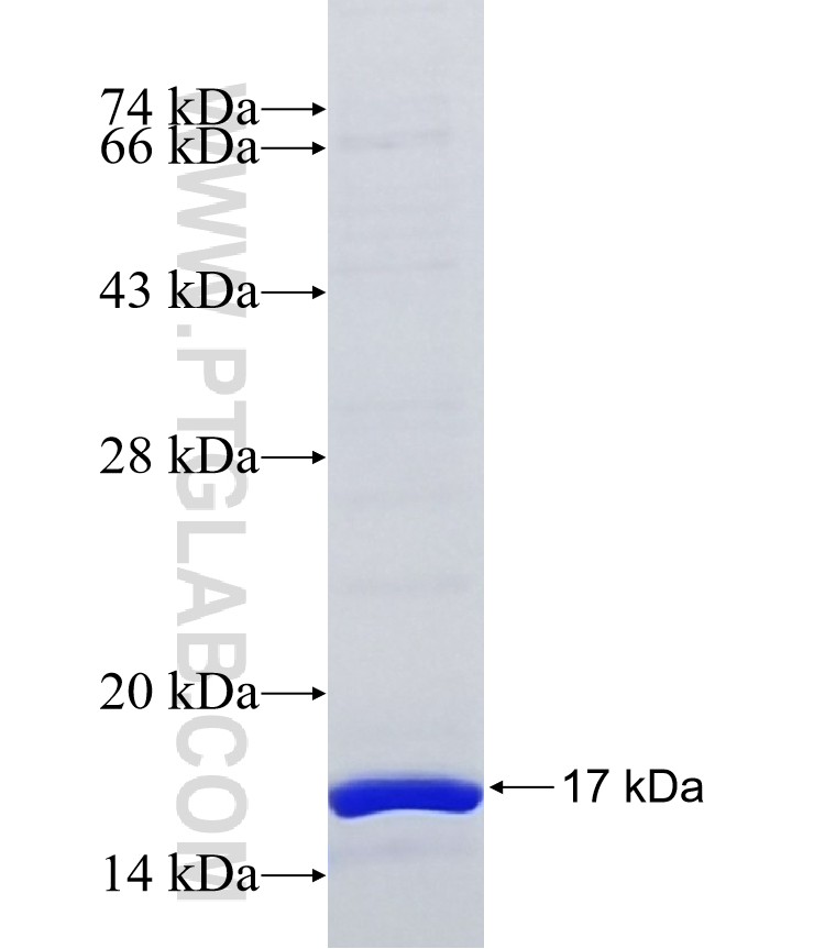 DONSON fusion protein Ag36503 SDS-PAGE