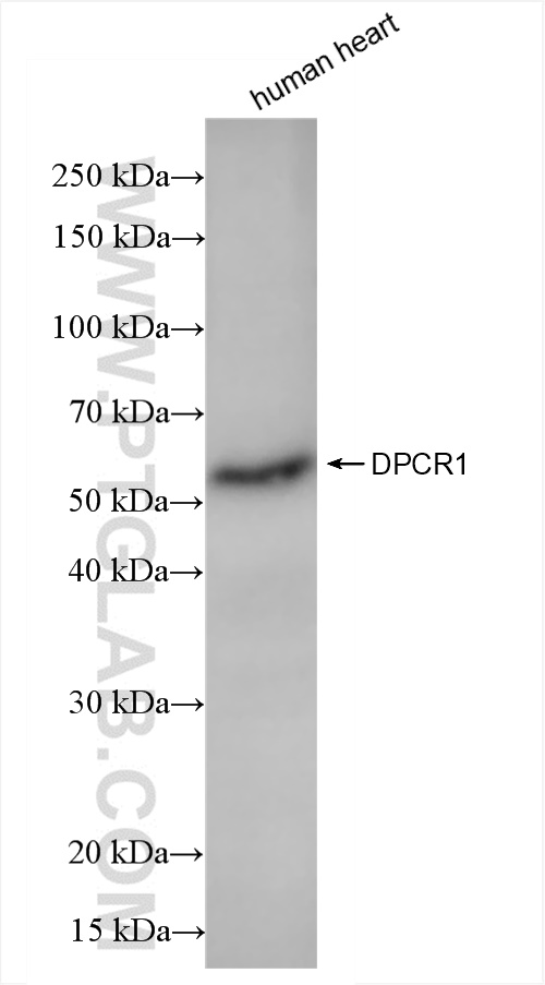 WB analysis of human heart using 84567-2-RR (same clone as 84567-2-PBS)
