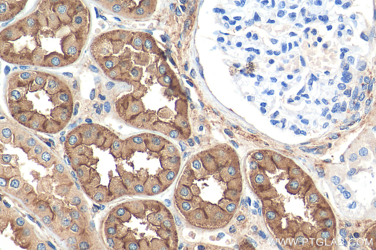 IHC staining of human kidney using 68081-1-Ig