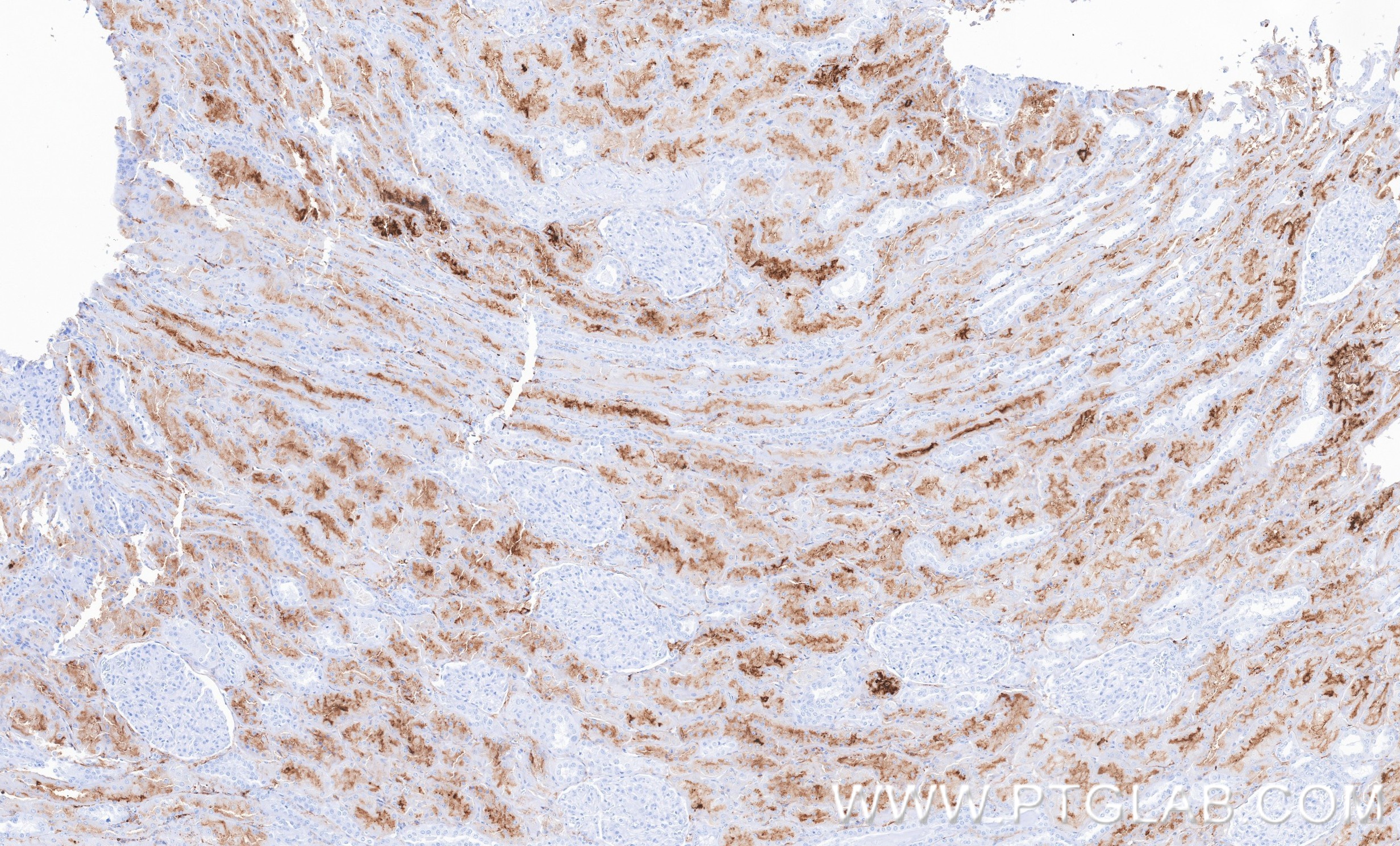 IHC staining of human kidney using 87384-1-RR (same clone as 87384-1-PBS) IHC staining of human kidney using 87384-1-RR (same clone as 87384-1-PBS)