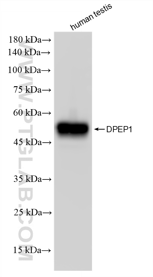 WB analysis of human testis using 87384-1-RR (same clone as 87384-1-PBS)