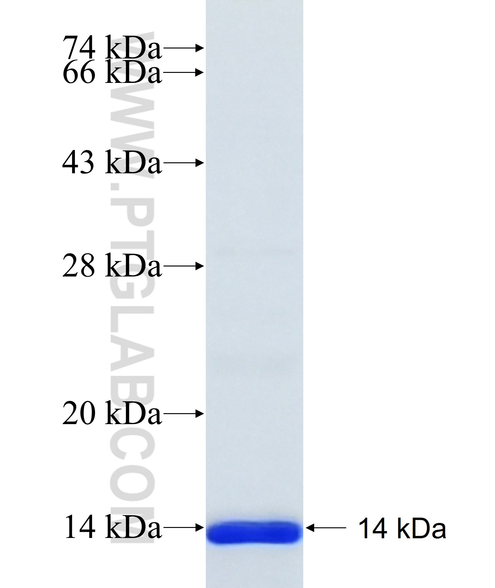DPEP3 fusion protein Ag35863 SDS-PAGE DPEP3 fusion protein Ag35863 SDS-PAGE