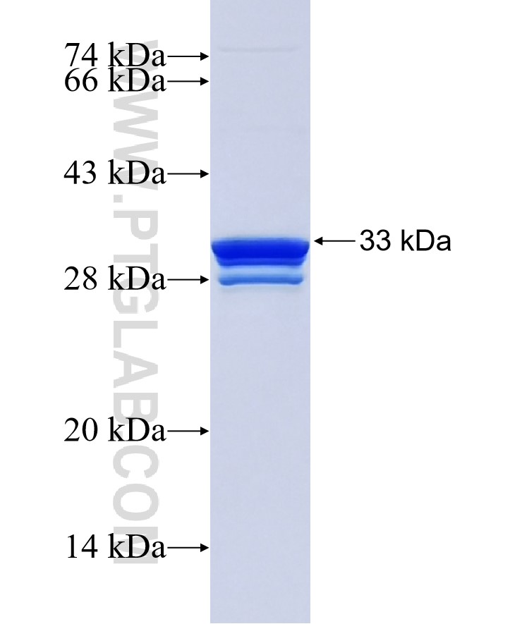 DPEP3 fusion protein Ag36039 SDS-PAGE