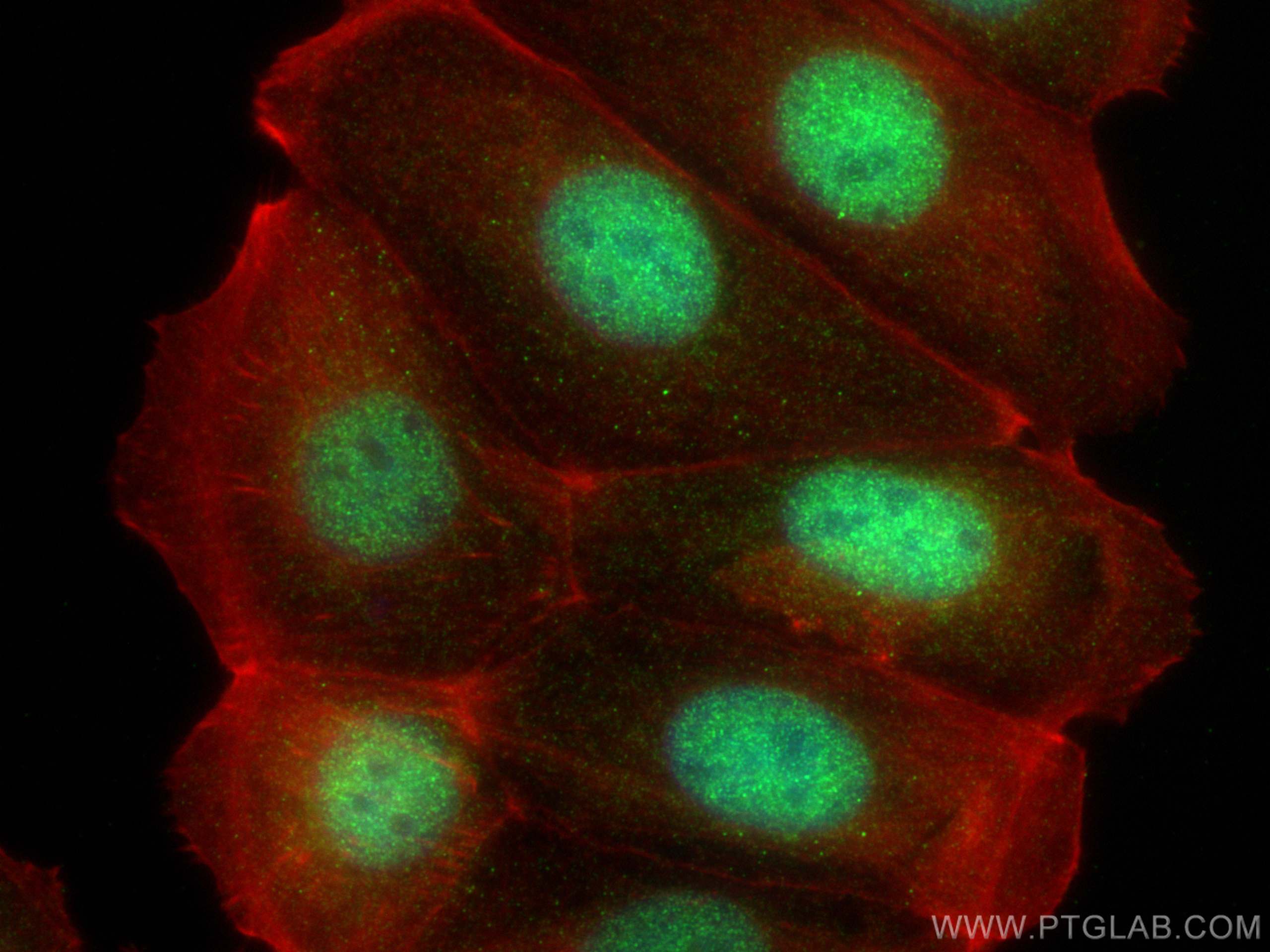 IF Staining of MCF-7 using 21769-1-AP