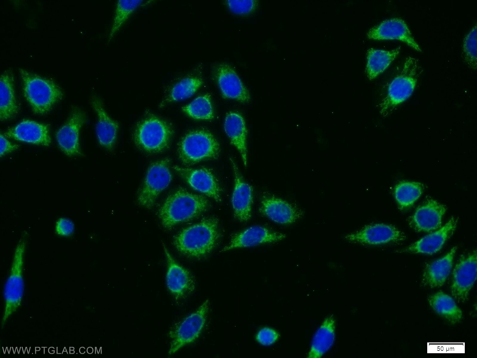 IF Staining of PC-3 using 12367-1-AP