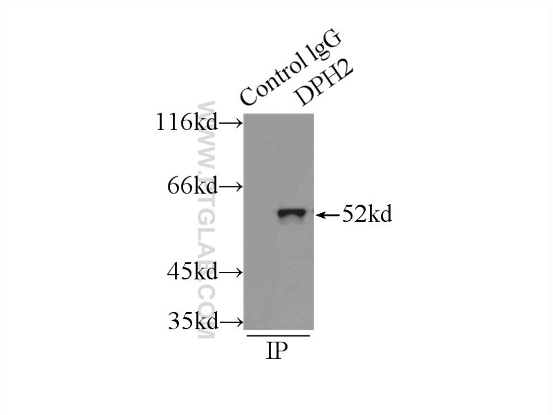 IP experiment of mouse skeletal muscle using 12367-1-AP