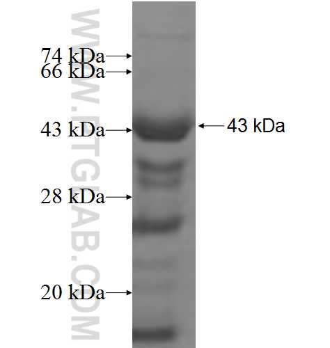 DPH2 fusion protein Ag7019 SDS-PAGE DPH2 fusion protein Ag7019 SDS-PAGE