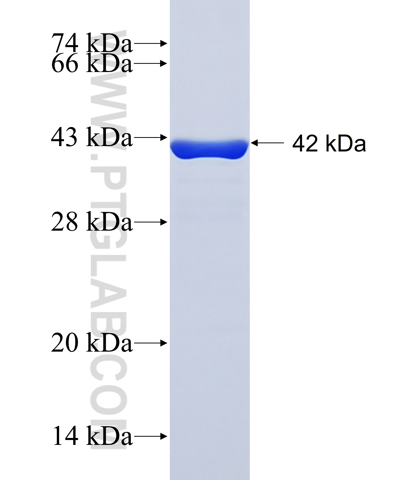DPH5 fusion protein Ag38953 SDS-PAGE DPH5 fusion protein Ag38953 SDS-PAGE