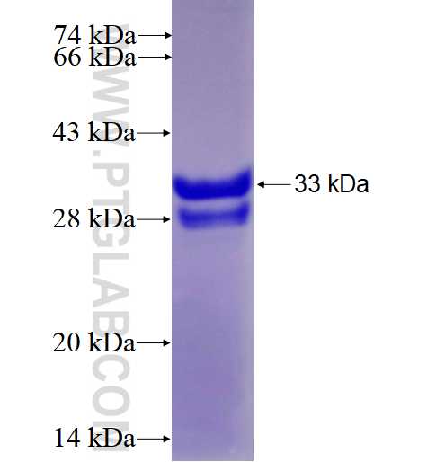 DPM3 fusion protein Ag3899 SDS-PAGE DPM3 fusion protein Ag3899 SDS-PAGE