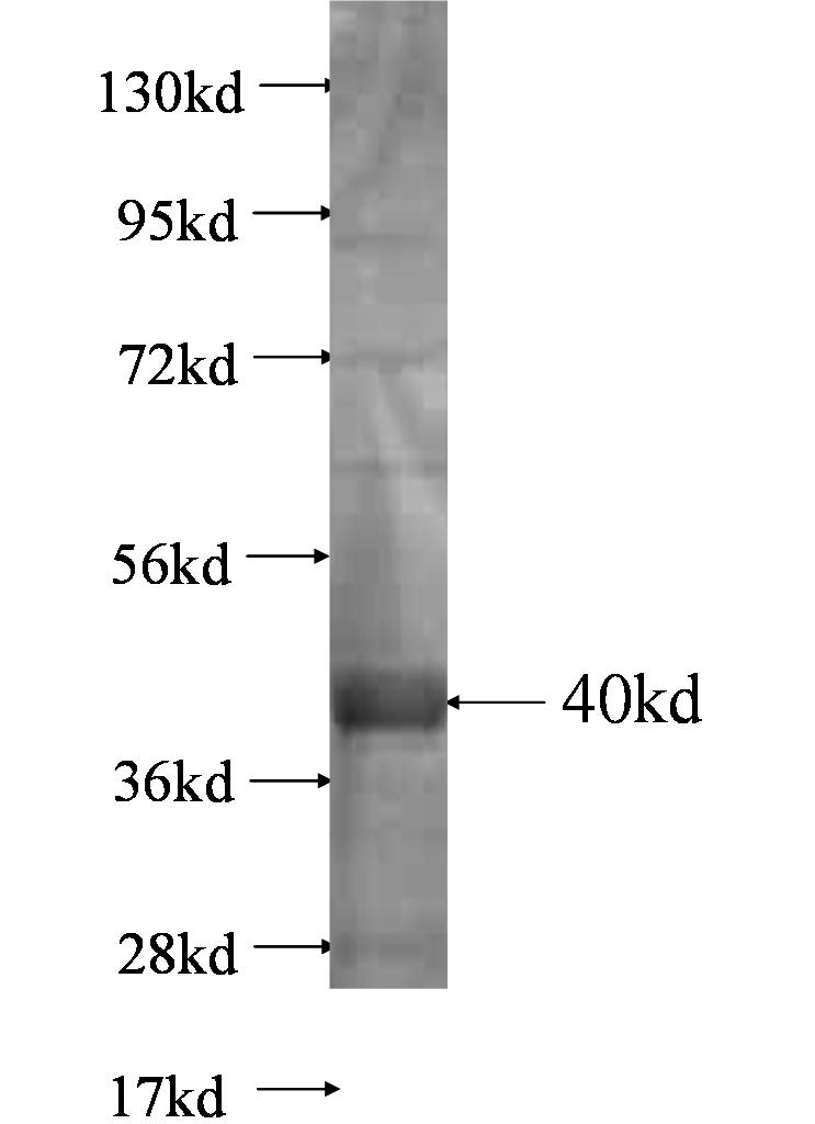 DPP10 fusion protein Ag0657 SDS-PAGE DPP10 fusion protein Ag0657 SDS-PAGE