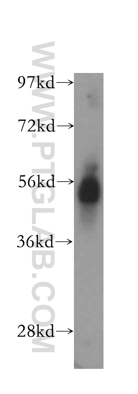 DPP4/CD26 Polyclonal antibody