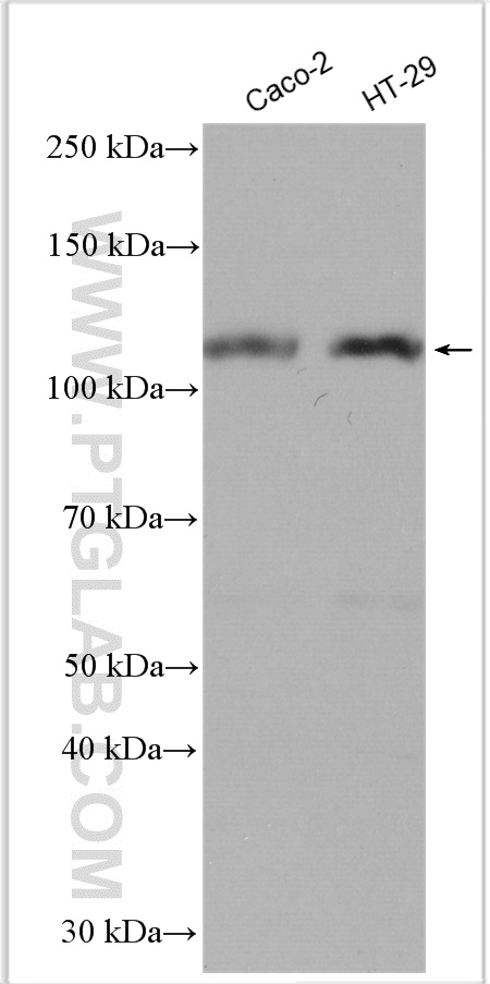 DPP4/CD26