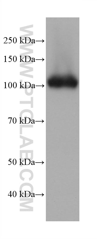 WB analysis of human placenta using 68383-1-Ig