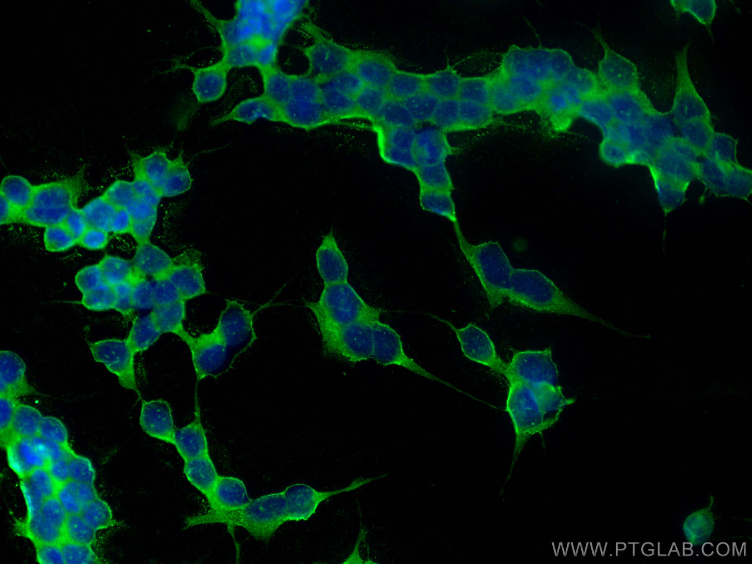 IF Staining of SH-SY5Y using 28143-1-AP