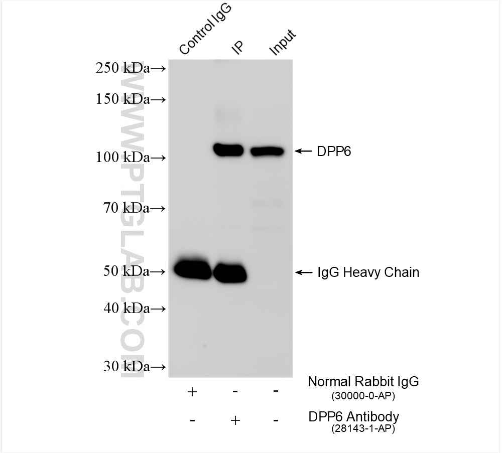 IP experiment of mouse brain using 28143-1-AP