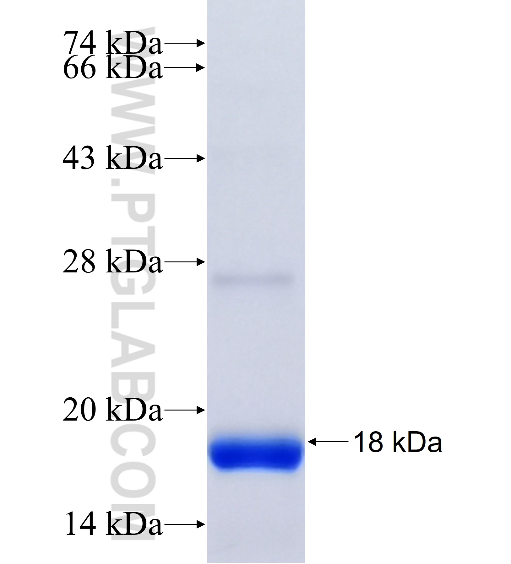 DPP9 fusion protein Ag41283 SDS-PAGE DPP9 fusion protein Ag41283 SDS-PAGE