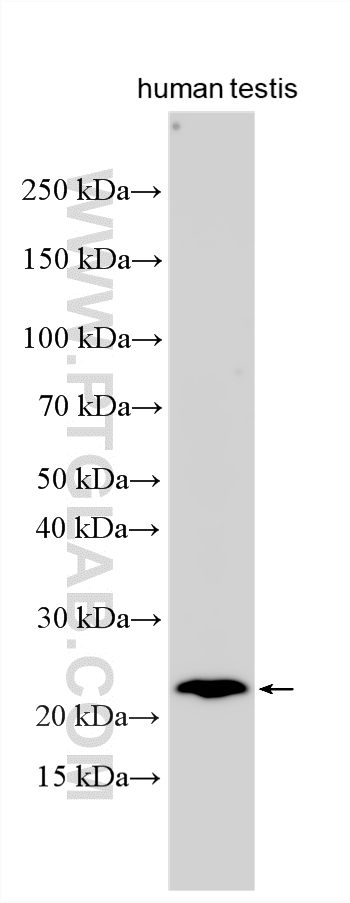 WB analysis using 33565-1-AP (same clone as 33565-1-PBS)