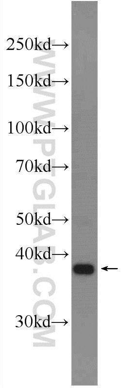 WB analysis of L02 using 17045-1-AP