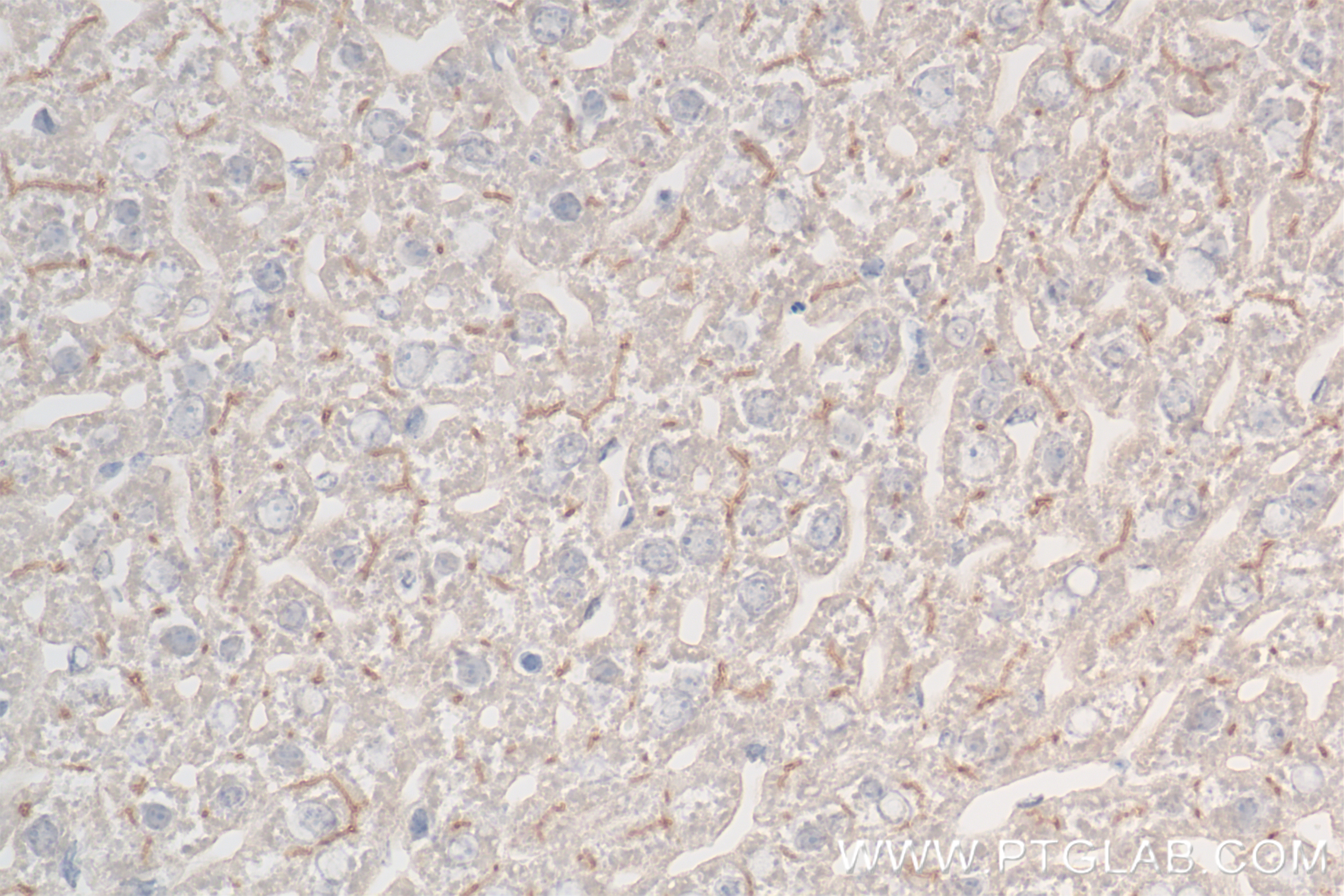 IHC staining of mouse liver using 85159-3-RR (same clone as 85159-3-PBS)