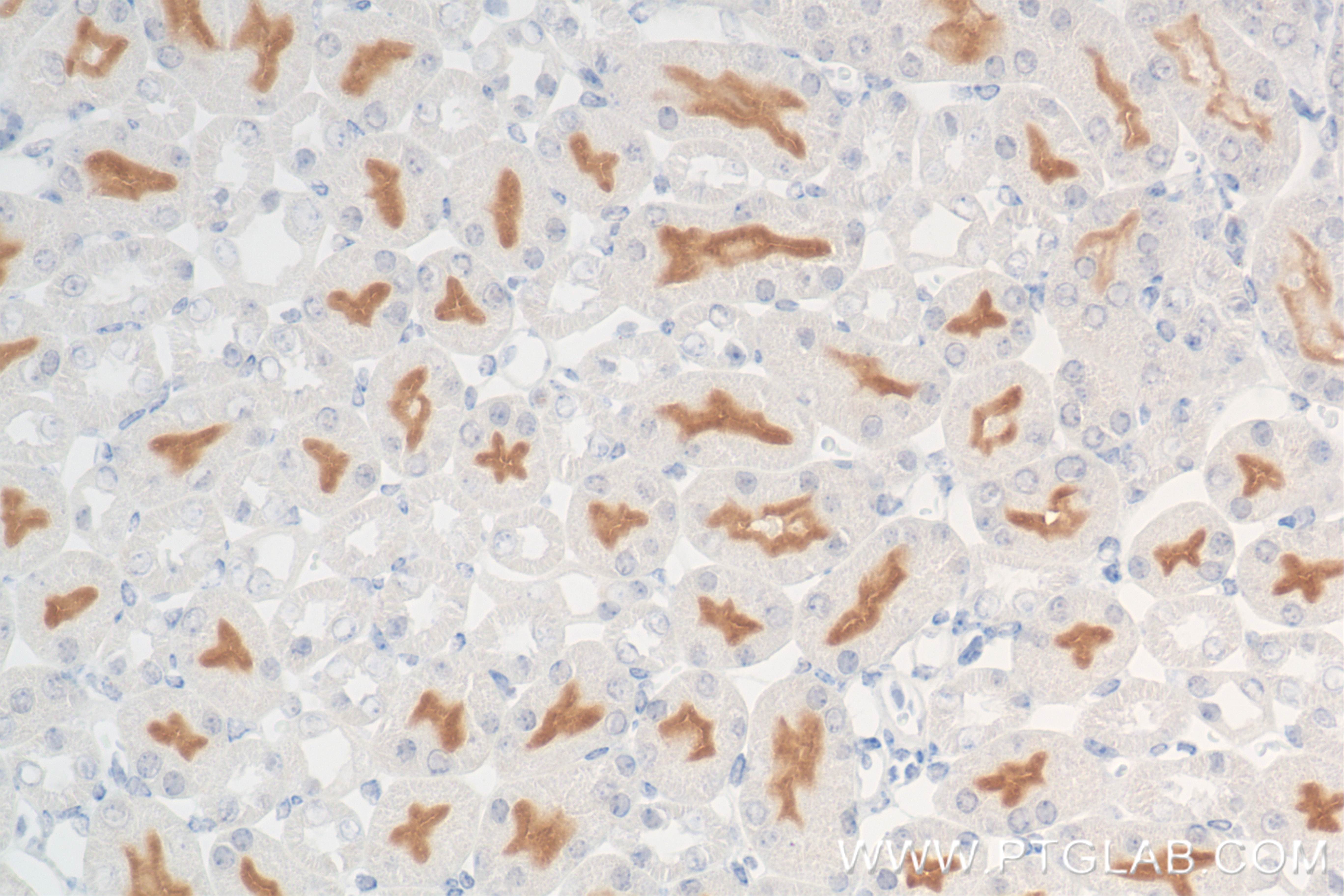IHC staining of mouse kidney using 85159-3-RR (same clone as 85159-3-PBS)