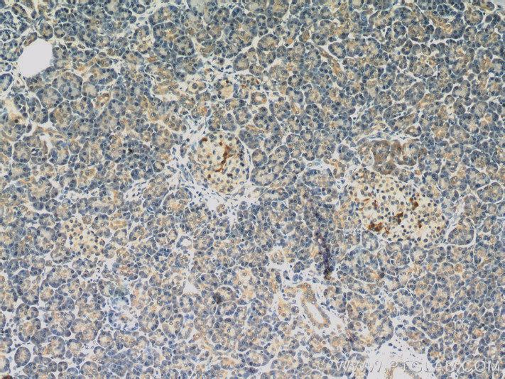 IHC staining of human pancreas using 10537-1-AP