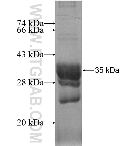 DPY19L3 fusion protein Ag15046 SDS-PAGE DPY19L3 fusion protein Ag15046 SDS-PAGE