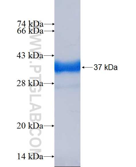 DPYD fusion protein Ag26599 SDS-PAGE