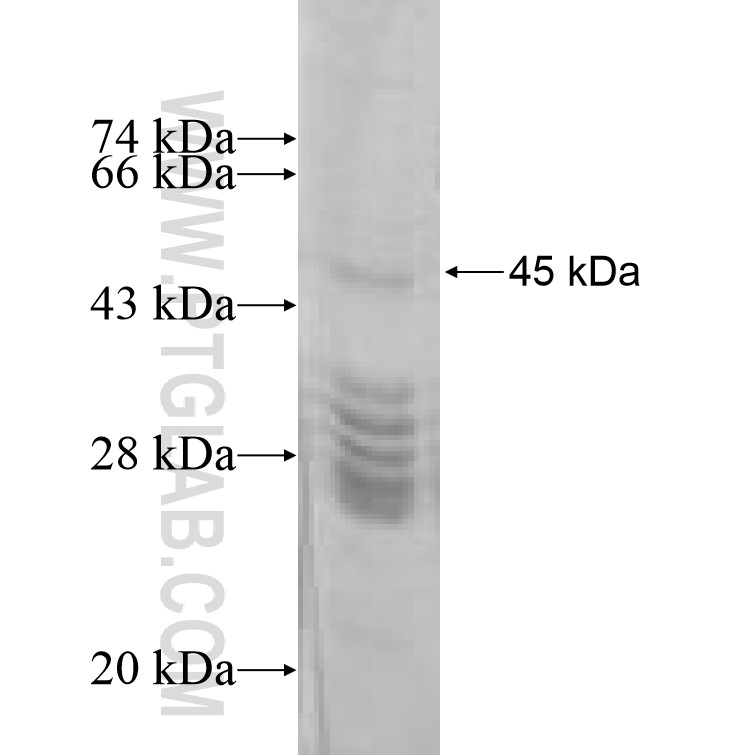 DPYD fusion protein Ag8866 SDS-PAGE DPYD fusion protein Ag8866 SDS-PAGE