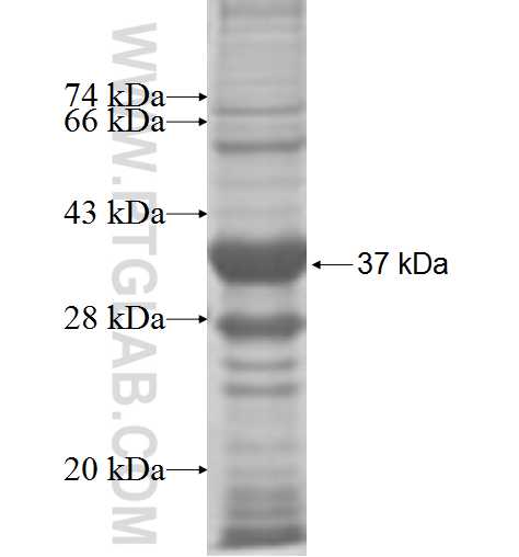 DPYS fusion protein Ag6925 SDS-PAGE DPYS fusion protein Ag6925 SDS-PAGE