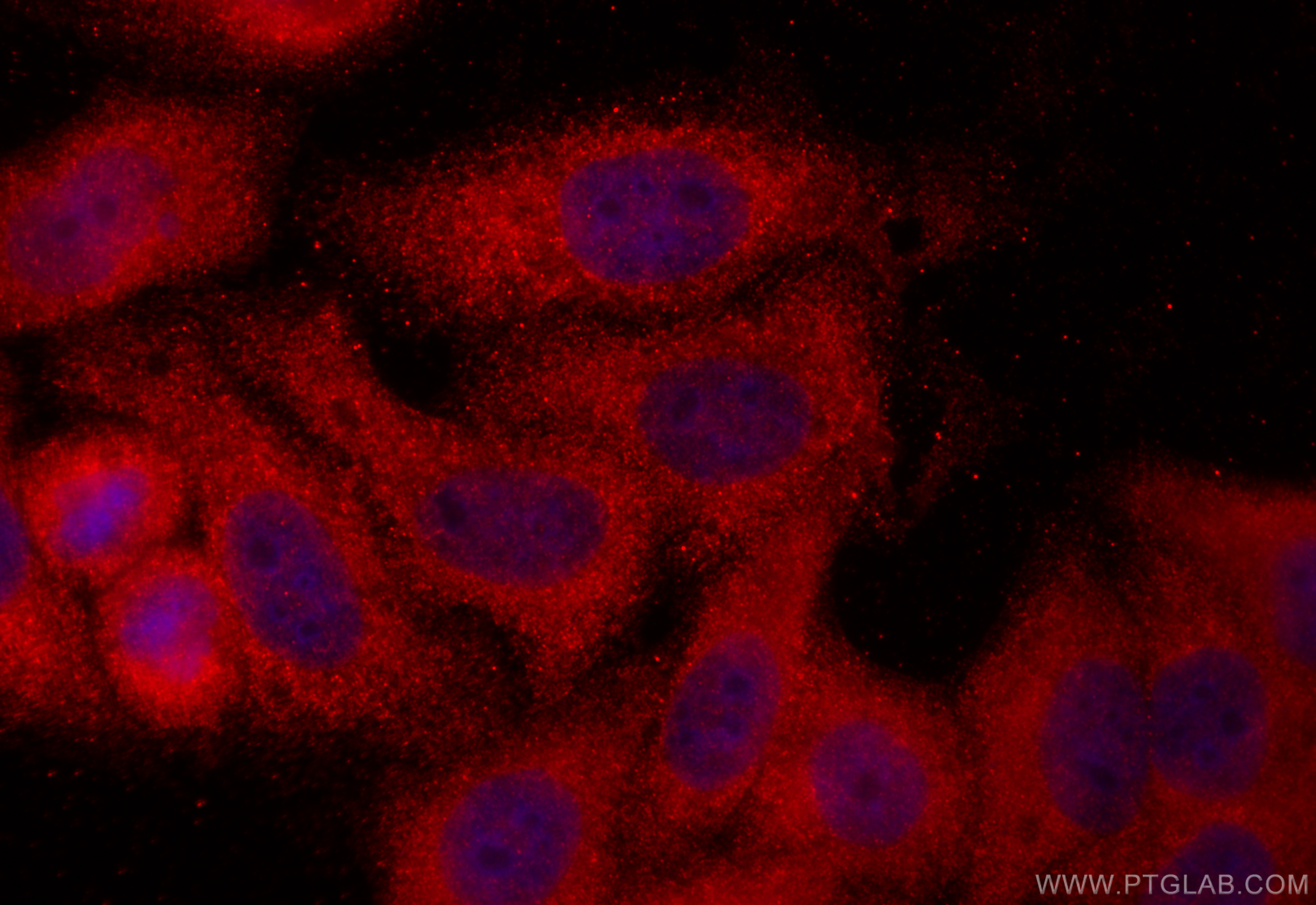 IF Staining of HepG2 using 18969-1-AP