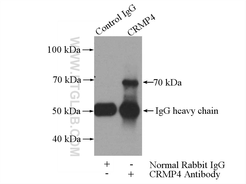 IP experiment of SH-SY5Y using 18969-1-AP