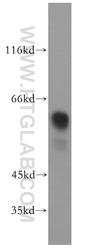 WB analysis of SH-SY5Y using 18969-1-AP