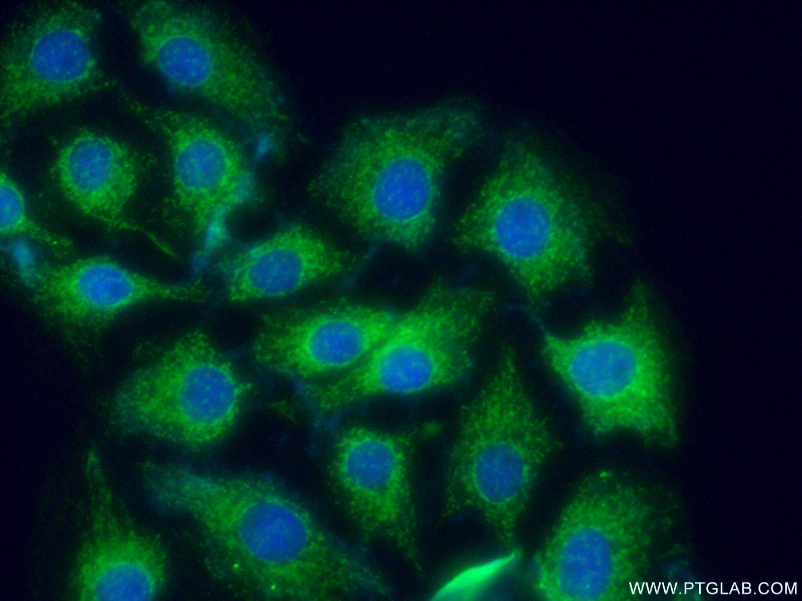 IF Staining of SH-SY5Y using 10525-1-AP