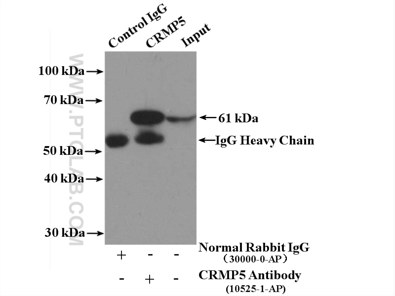 IP experiment of mouse brain using 10525-1-AP