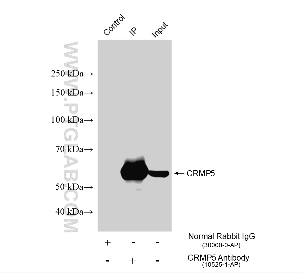 IP experiment of mouse brain using 10525-1-AP