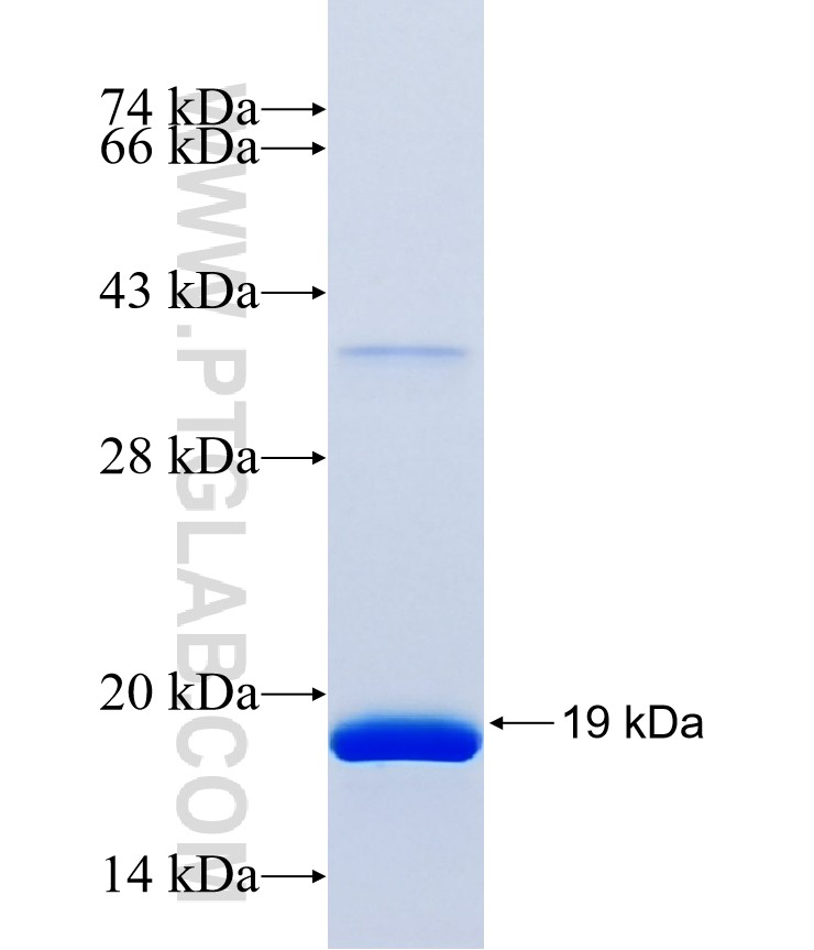 DQX1 fusion protein Ag40814 SDS-PAGE