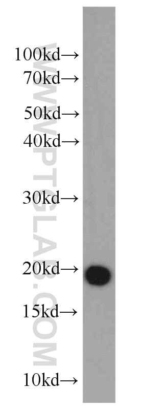 WB analysis of mouse testis using 10406-1-AP