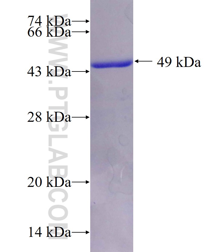 DR1 fusion protein Ag0664 SDS-PAGE