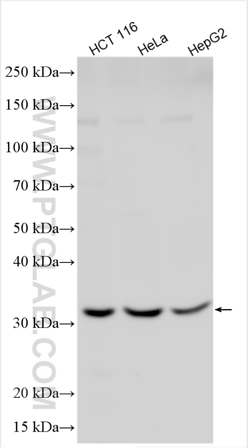 WB analysis using 31777-1-AP