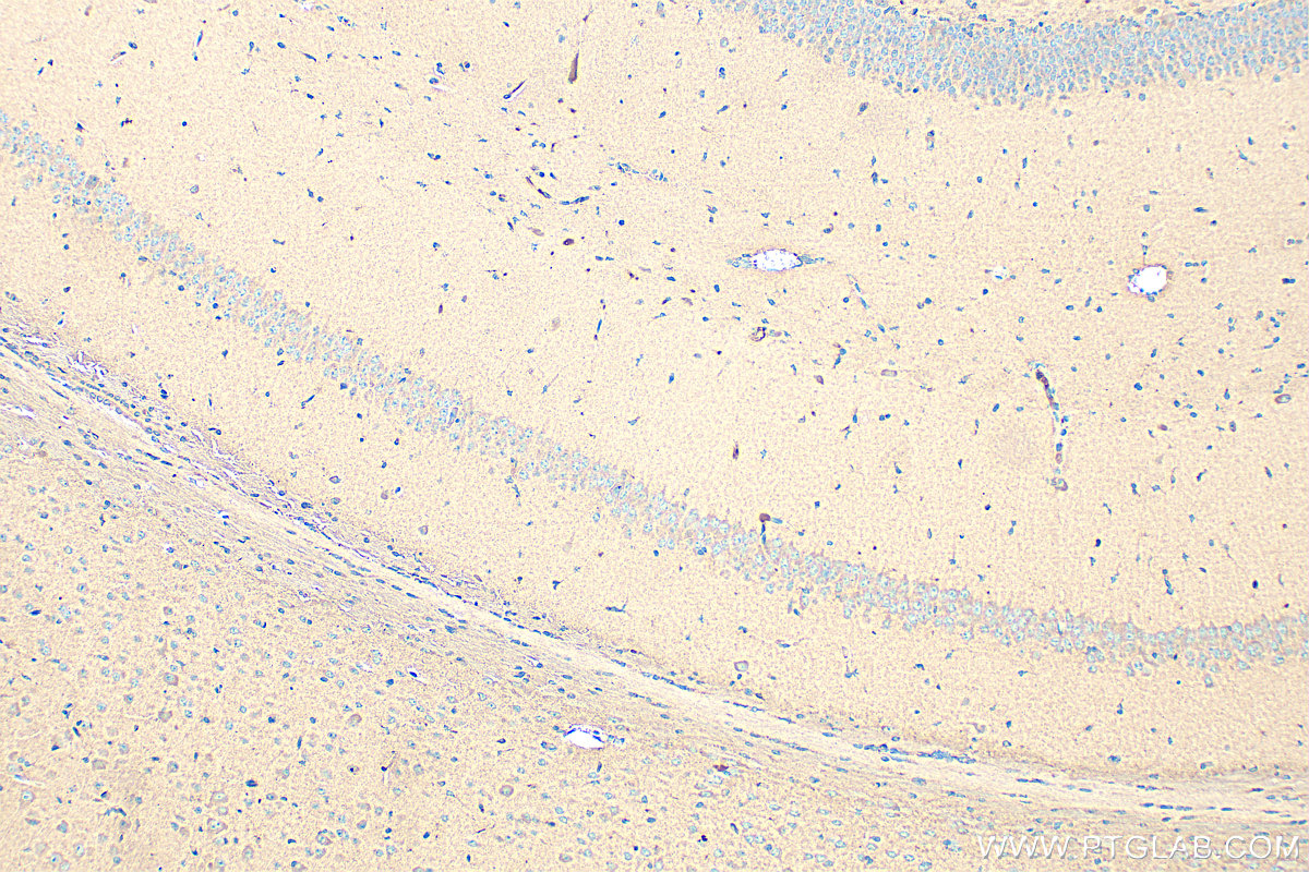 IHC staining of mouse brain using 17934-1-AP