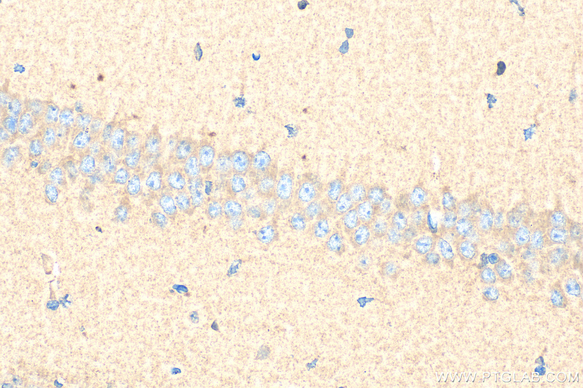 IHC staining of mouse brain using 17934-1-AP
