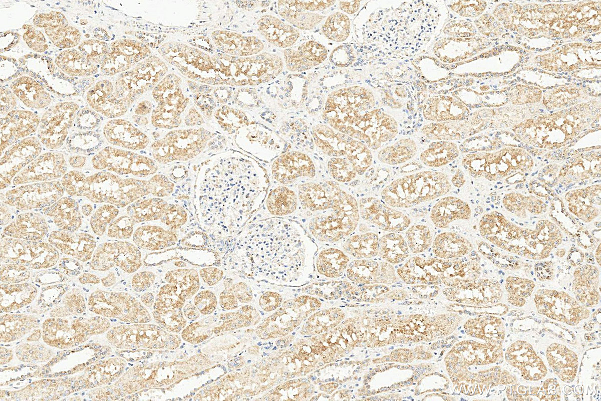 IHC staining of human kidney using 17934-1-AP IHC staining of human kidney using 17934-1-AP