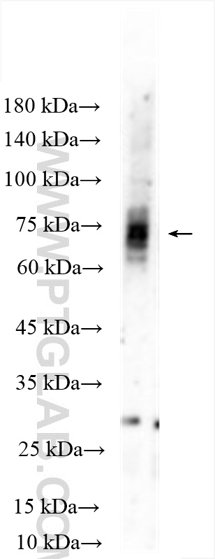 WB analysis of mouse brain using 17934-1-AP