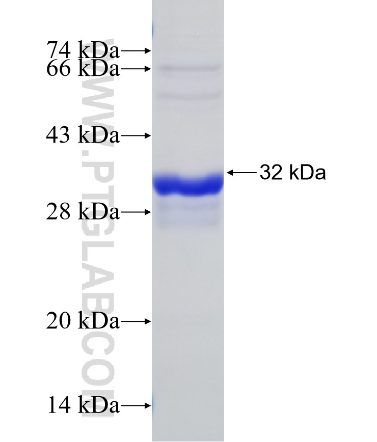 DRD1 fusion protein Ag29521 SDS-PAGE DRD1 fusion protein Ag29521 SDS-PAGE