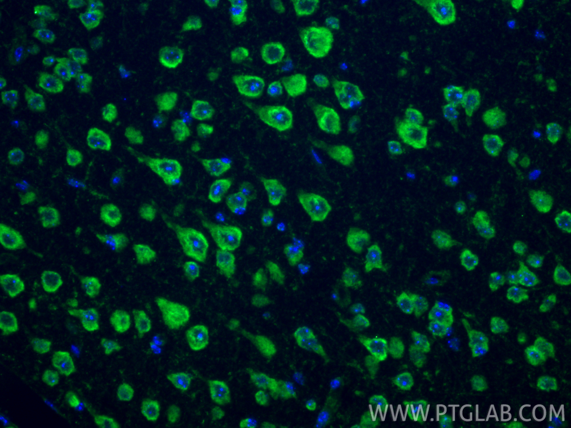 IF Staining of mouse brain using 55084-1-AP