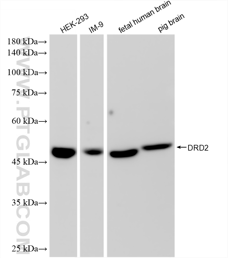WB analysis using 88509-1-RR WB analysis using 88509-1-RR