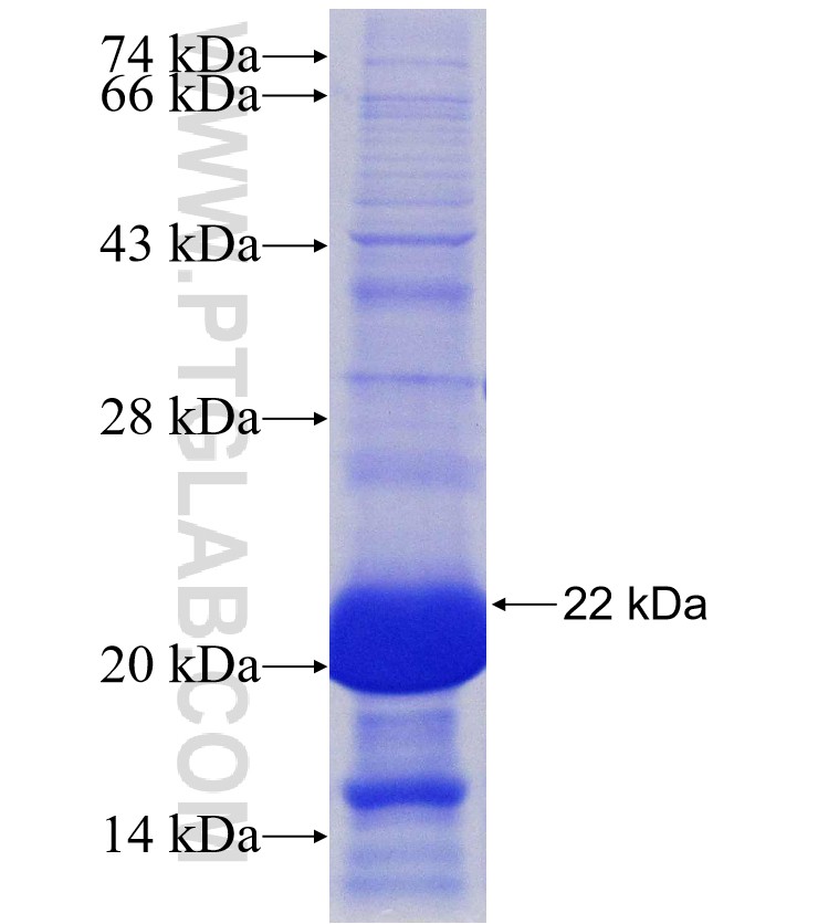 DRD5 fusion protein Ag14839 SDS-PAGE