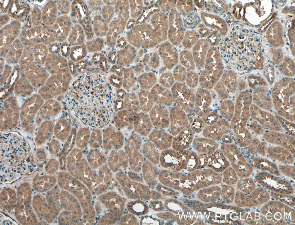 IHC staining of human kidney using 14743-1-AP