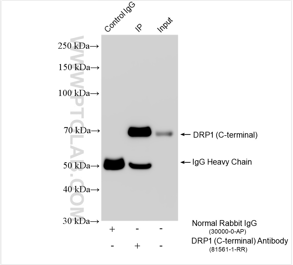 IP experiment of PC-12 using 81561-1-RR (same clone as 81561-1-PBS)